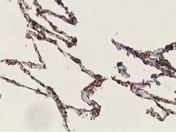 ADH1B Mouse anti-Human, Clone: OTI1C3, lyophilized, TrueMAB 100 &mu;g;