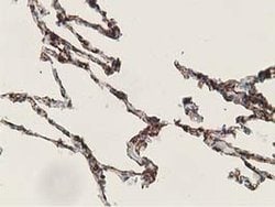 ADH1B Monoclonal Antibody (OTI1C3), TrueMAB , OriGene 100 &mu;L; Unconjugated:Antibodies,