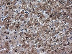 ADH1B Monoclonal Antibody (OTI1H7), TrueMAB , OriGene 30 &mu;L; Unconjugated:Antibodies,