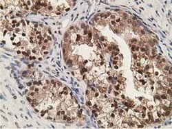 ADH1B Mouse anti-Human, Rat, Clone: OTI4F12, liquid, TrueMAB 30 &mu;L;