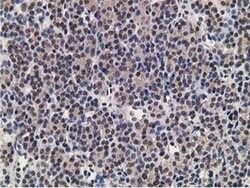 ADH1B Mouse anti-Human, Rat, Clone: OTI4F12, liquid, TrueMAB 30 &mu;L;