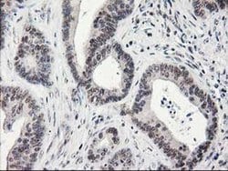 ADH1B Mouse anti-Human, Rat, Clone: OTI4F12, liquid, TrueMAB 30 &mu;L;
