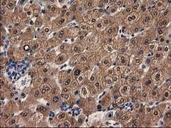 ADH1B Mouse anti-Human, Rat, Clone: OTI4F12, liquid, TrueMAB 30 &mu;L;