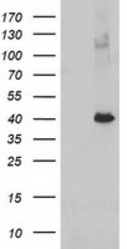 ADH1B Mouse anti-Human, Clone: OTI1C3, lyophilized, TrueMAB 100 &mu;g;
