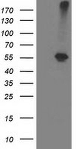 ADH1B Monoclonal Antibody (OTI1H7), TrueMAB , OriGene 30 &mu;L; Unconjugated:Antibodies,