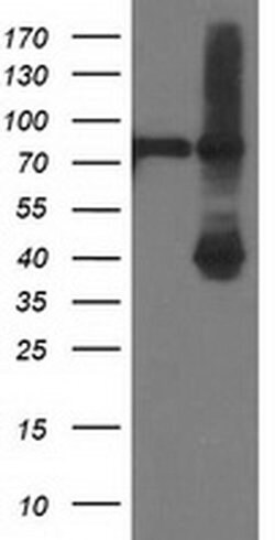 ADH1B Mouse anti-Human, Rat, Clone: OTI4F12, liquid, TrueMAB 30 &mu;L;