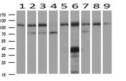 ADH1B Mouse anti-Human, Rat, Clone: OTI4F12, liquid, TrueMAB 30 &mu;L;