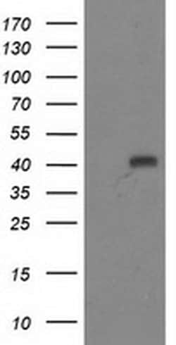 ADH1B Monoclonal Antibody (OTI3C12), TrueMAB , OriGene:Antibodies:Primary