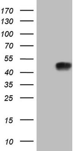 ADH5 Mouse anti-Human, Clone: OTI4H3, liquid, TrueMAB 100 &mu;L; Unconjugated:Antibodies,