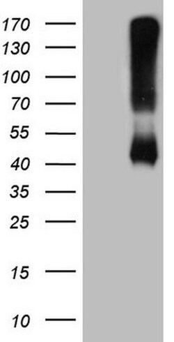 ADH5 Monoclonal Antibody (OTI5G4), TrueMAB , OriGene 100 &mu;L; Unconjugated:Antibodies,