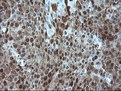 ADH7 Monoclonal Antibody (OTI2H10), TrueMAB , OriGene 30 &mu;L; Unconjugated:Antibodies,