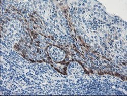ADH7 Monoclonal Antibody (OTI2D11), TrueMAB , OriGene 100 &mu;L; Unconjugated:Antibodies,