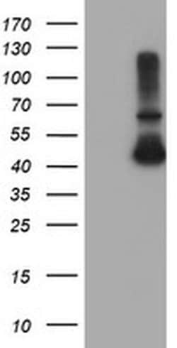 ADH7 Monoclonal Antibody (OTI2C3), TrueMAB , OriGene 30 &mu;L; Unconjugated:Antibodies,