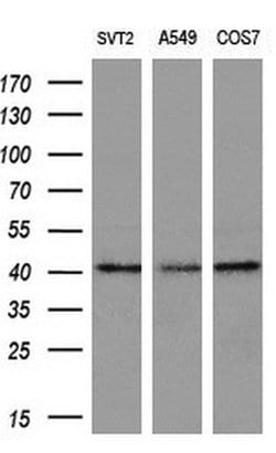 ADH7 Monoclonal Antibody (OTI2H10), TrueMAB , OriGene 30 &mu;L; Unconjugated:Antibodies,