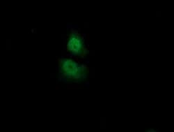 ADI1 Monoclonal Antibody (OTI3H6), TrueMAB , OriGene 100 &mu;L; Unconjugated:Antibodies,