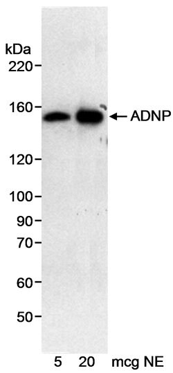 ADNP Rabbit anti-Human, Polyclonal, Bethyl Laboratories 100 &mu;L; Unconjugated:Antibodies,
