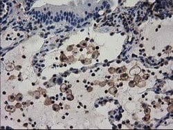 ADSL Mouse anti-Canine, Human, Rat, Clone: OTI2D10, lyophilized, TrueMAB
