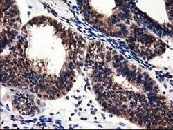 ADSL Mouse anti-Canine, Human, Rat, Clone: OTI2D10, lyophilized, TrueMAB