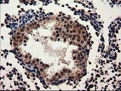 ADSL Mouse anti-Canine, Human, Rat, Clone: OTI2D10, lyophilized, TrueMAB