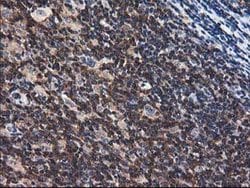 ADSL Mouse anti-Canine, Human, Rat, Clone: OTI2D10, lyophilized, TrueMAB