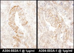 AE2 Rabbit anti-Human, Polyclonal, Bethyl Laboratories 100 &mu;L; Unconjugated:Antibodies,