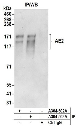 AE2 Rabbit anti-Human, Polyclonal, Bethyl Laboratories 100 &mu;L; Unconjugated:Antibodies,