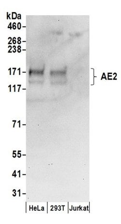 AE2 Rabbit anti-Human, Polyclonal, Bethyl Laboratories 100 &mu;L; Unconjugated:Antibodies,
