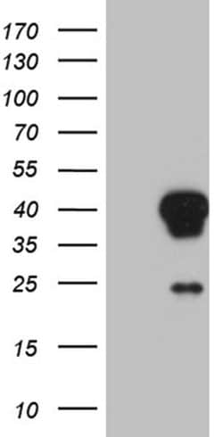 AEBP2 Monoclonal Antibody (OTI8G9), TrueMAB , OriGene 100 &mu;L | Buy Online | Origene Technologies | Fisher Scientific