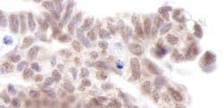 AF9 Polyclonal Antibody, Bethyl Laboratories:Antibodies:Primary Antibodies