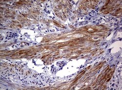 AFAP1 Monoclonal Antibody (OTI2G9), TrueMAB , OriGene 100 &mu;L; Unconjugated:Antibodies,
