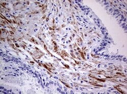 AFAP1 Monoclonal Antibody (OTI2G9), TrueMAB , OriGene 100 &mu;L; Unconjugated:Antibodies,