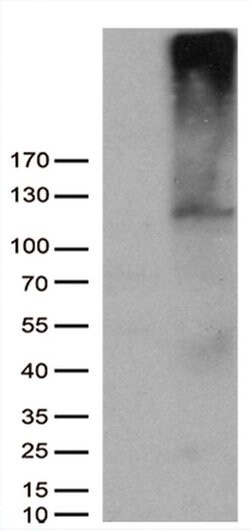 AFAP1 Monoclonal Antibody (OTI1E9), TrueMAB , OriGene 100 &mu;L; Unconjugated:Antibodies,