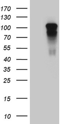 AFAP1 Mouse anti-Human, Clone: OTI2D11, lyophilized, TrueMAB 100 &mu;g;