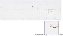 AFP Mouse anti-Human, Clone: UMAB66, liquid, UltraMAB 100 &mu;L; Unconjugated:Antibodies,