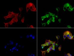 AFP Mouse anti-Human, Clone: UMAB66, liquid, UltraMAB 100 &mu;L; Unconjugated:Antibodies,