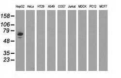 AFP Monoclonal Antibody (OTI1E8), TrueMAB , OriGene 100 &mu;L; Unconjugated:Antibodies,