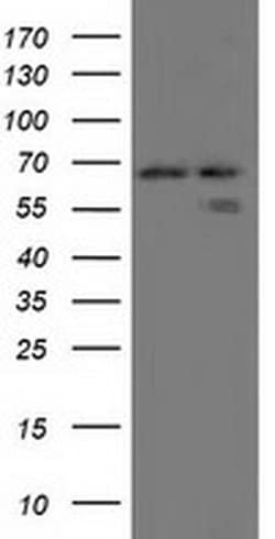 AFP Monoclonal Antibody (OTI1D1), TrueMAB , OriGene:Antibodies:Primary