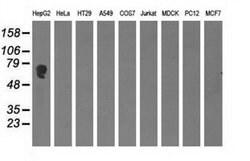 AFP Monoclonal Antibody (OTI3B5), TrueMAB , OriGene 100 &mu;L; Unconjugated:Antibodies,