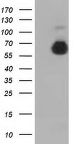 AFP Monoclonal Antibody (OTI2E2), TrueMAB , OriGene 100 &mu;L; Unconjugated:Antibodies,