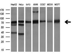AFP Monoclonal Antibody (OTI2E2), TrueMAB , OriGene 100 &mu;L; Unconjugated:Antibodies,