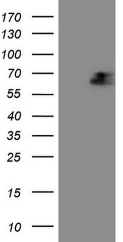 AFP Monoclonal Antibody (OTI4G9), TrueMAB , OriGene 100 &mu;L; Unconjugated:Antibodies,