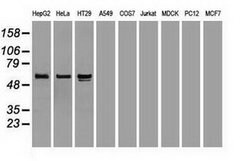 AFP Monoclonal Antibody (OTI4G9), TrueMAB , OriGene 100 &mu;L; Unconjugated:Antibodies,