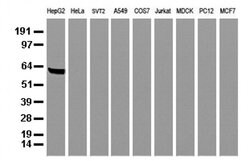 AFP Mouse anti-Human, Clone: UMAB66, liquid, UltraMAB 100 &mu;L; Unconjugated:Antibodies,