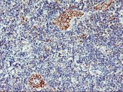 AGAP1 Monoclonal Antibody (OTI4E8), TrueMAB , OriGene 100 &mu;L; Unconjugated:Antibodies,