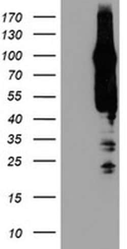 AGAP1 Monoclonal Antibody (OTI4E8), TrueMAB , OriGene 100 &mu;L; Unconjugated:Antibodies,