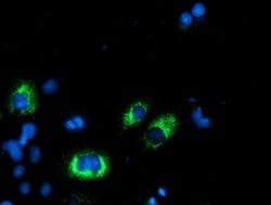 AGPAT5 Monoclonal Antibody (OTI2C4), TrueMAB , OriGene 30 &mu;L; Unconjugated:Antibodies,
