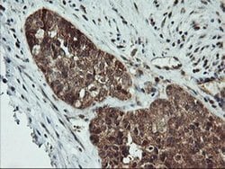 AGPAT5 Monoclonal Antibody (OTI1H10), TrueMAB , OriGene:Antibodies:Primary