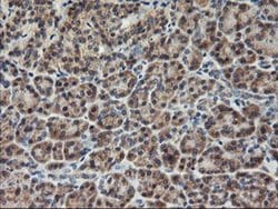 AGPAT5 Monoclonal Antibody (OTI1H10), TrueMAB , OriGene 30 &mu;L; Unconjugated:Antibodies,