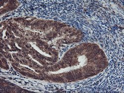 AGPAT5 Monoclonal Antibody (OTI1H10), TrueMAB , OriGene 30 &mu;L; Unconjugated:Antibodies,