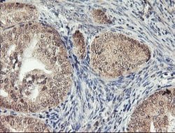 AGPAT5 Monoclonal Antibody (OTI2C4), TrueMAB , OriGene 30 &mu;L; Unconjugated:Antibodies,